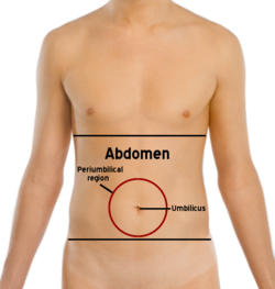 Abdomen and Pelvis CT Scan