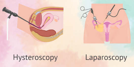 laparoscopy and hysteroscopy