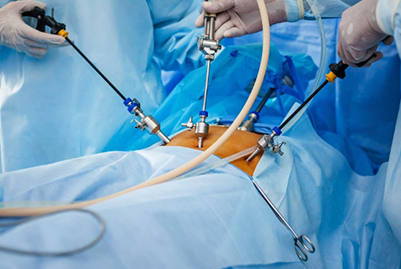 Laparoscopic Tubal Reconstruction Surgery